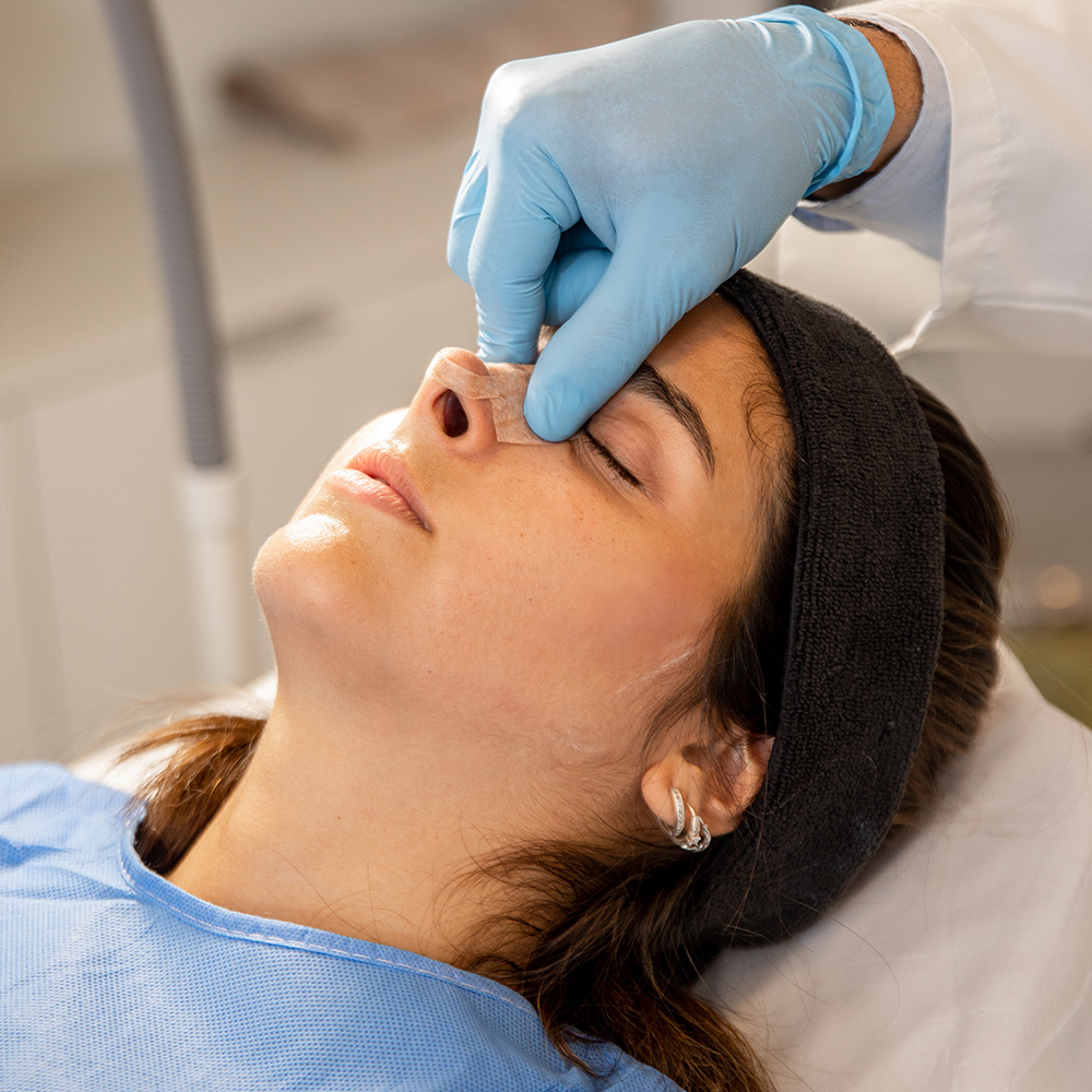 Rinoplastia